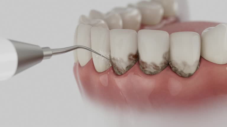 Reliable Dental Implants contractor in Elliston, VA by Smile Center Dentistry